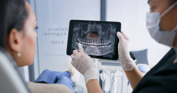 Licensed Invisalign Clear Aligners service in Angwin, CA - Dentist Open Now